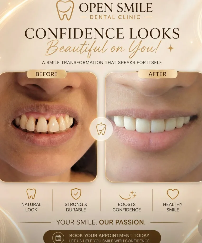 Open Smile Dental Clinic