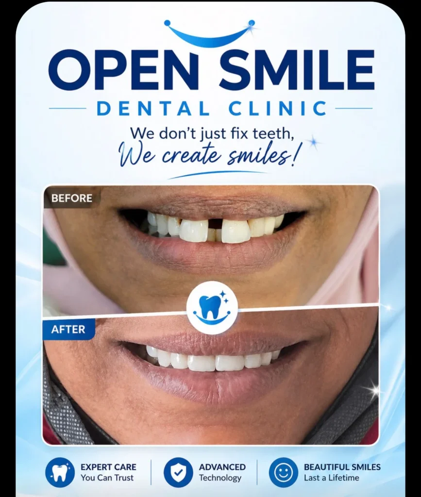 Open Smile Dental Clinic