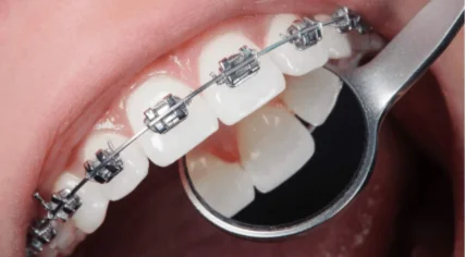 Smile Lounge Dental Clinic