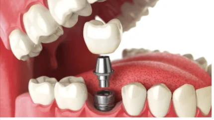 Smile Lounge Dental Clinic